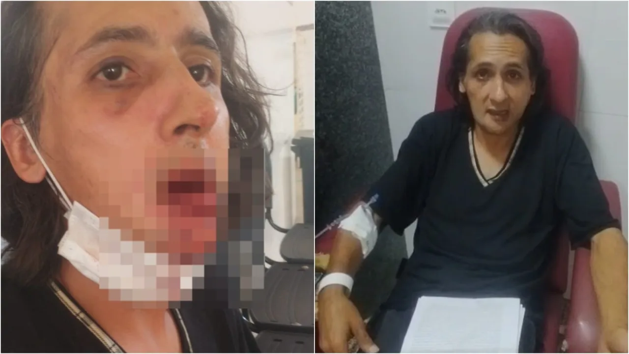 Imagem de câmera de segurança registrando momento de agressão física na frente da sede da cooperativa.