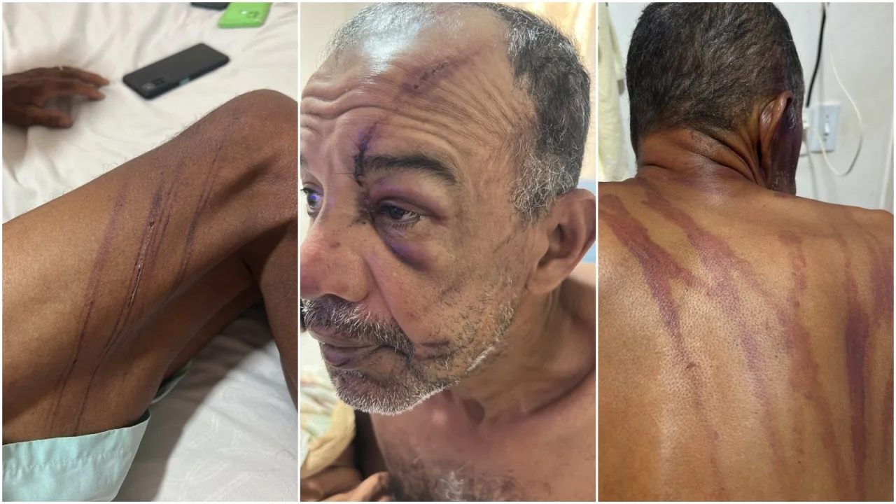 Adilson Alves Viana, vítima de agressão na Praia do Futuro.