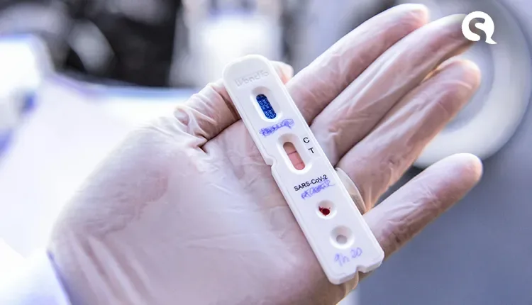 Câmara aprova prioridade de profissionais em testes de covid-19