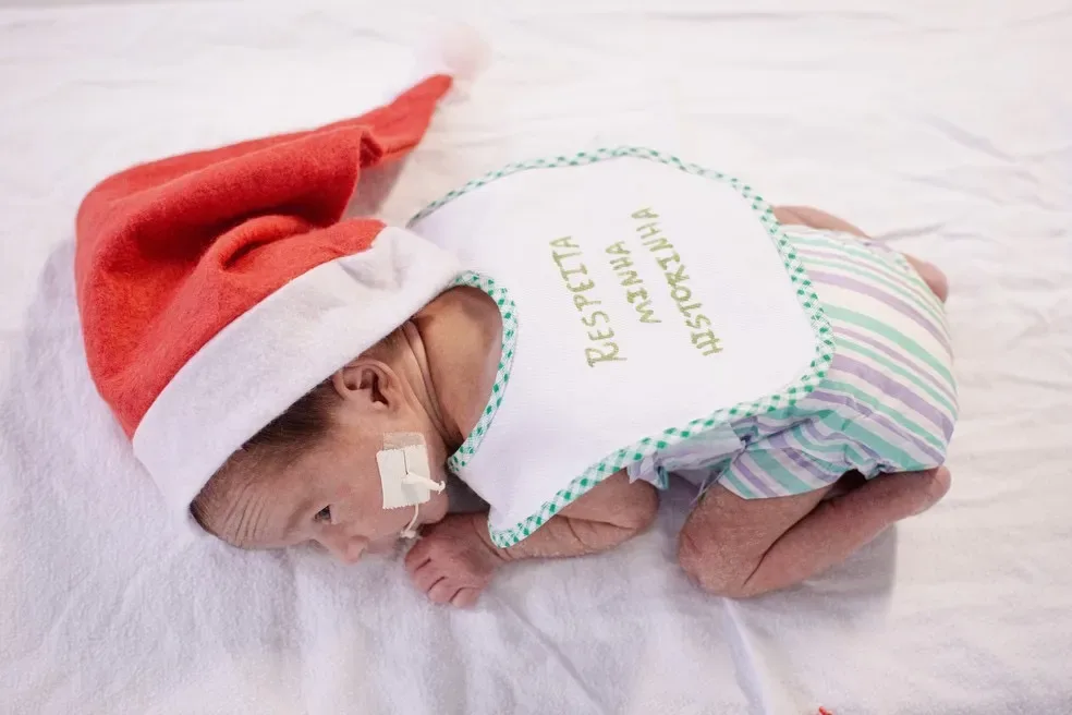 Bebês prematuros internados em UTI em hospital de Fortaleza fazem sessão de fotos de Natal