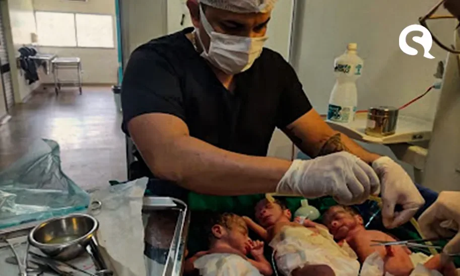 Médico se surpreende ao ‘descobrir’ 3º bebê durante parto de gêmeos