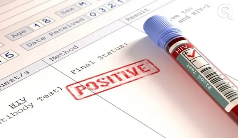 Cientistas: surgimento da Ômicron pode estar ligado a HIV não tratado