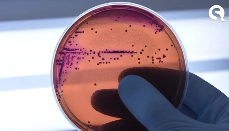 Pesquisa traz evidências de surgimento de superbactéria na natureza há 200 anos