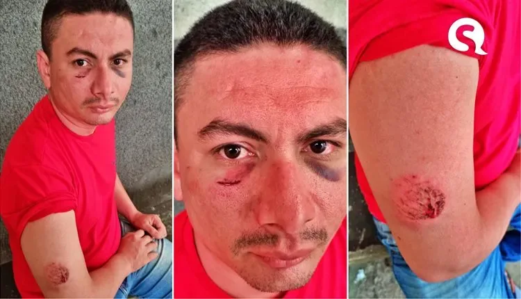 Jovem morto em Camocim, disse que: “ia matar mulher e filhos de PM”, diz família