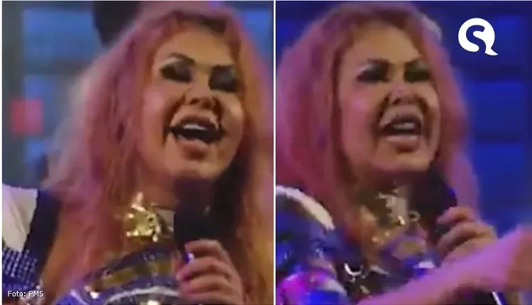 Joelma aparece com rosto inchado e impressiona internautas: “o que houve?”