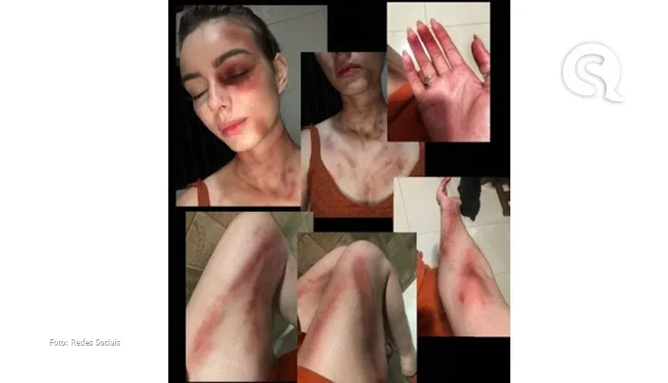 Mulher é agredida, sofre tentativa de estupro e luta com agressor no interior do Ceará