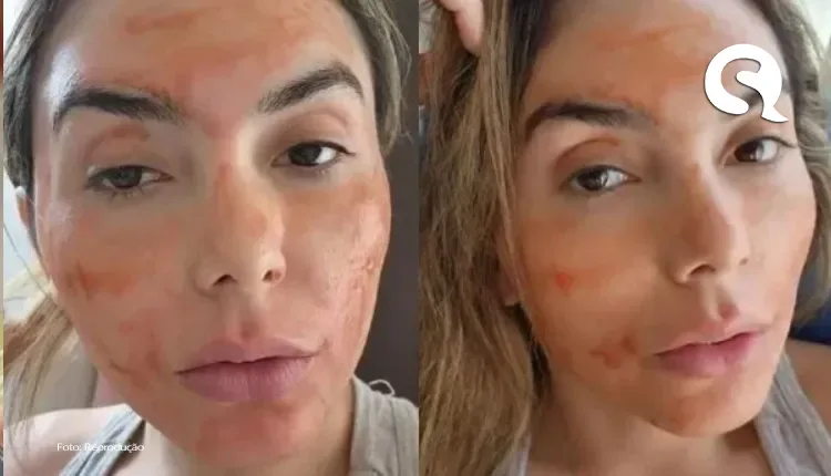 Influenciadora usa sangue menstrual no skincare: “Pele de bebê”