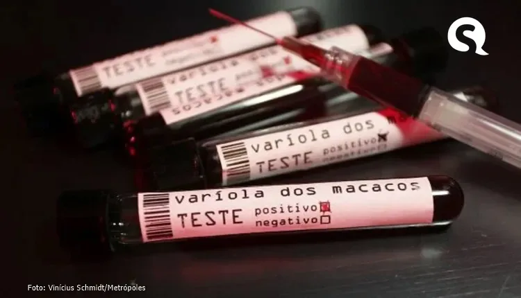 Monkeypox: Anvisa dá autorização emergencial para testes da Fiocruz
