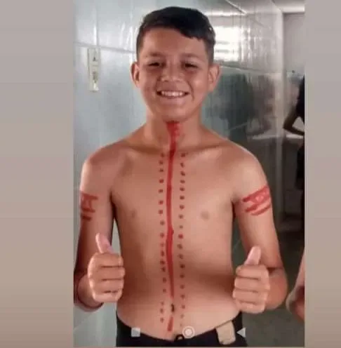 Adolescente morre após colidir motocicleta em um poste na zona rural de Acaraú