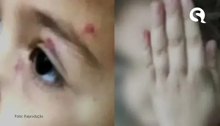 Criança diz ter sido agredida em escola no PR: “Bateu na minha cara”