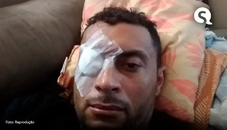 Eletricista sofre com problema no olho, e espera há três anos em fila por cirurgia ocular no Ceará