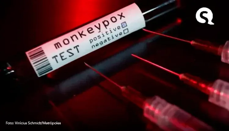 Sergipe registra cinco novos casos confirmados de mpox