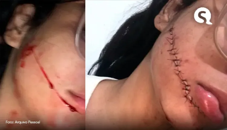 Pai da jovem que teve rosto cortado enquanto dormia em viagem de ônibus na BA pede justiça: ‘pode ser fatal’