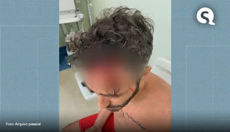 Imagem mostra ator Thiago Rodrigues ferido após assalto na Gávea