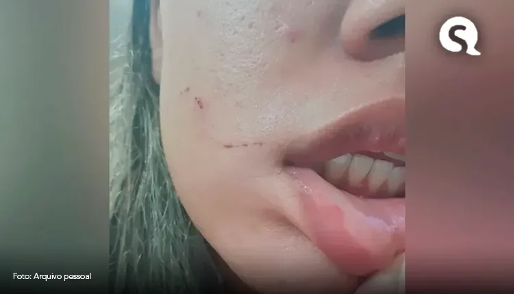 Segunda jovem afirma ter sido agredida por médico no Ceará: ‘Disse que iria me matar’