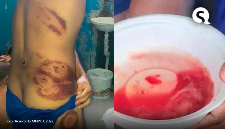 Órgão federal aponta tortura, comida estragada e contaminação proposital por tuberculose em presídios do RN