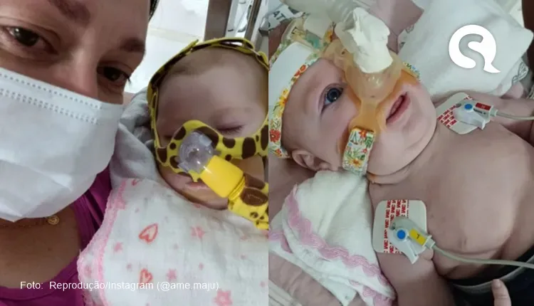 Perfil falso no TikTok utiliza imagens de bebê com doença rara para aplicar golpes