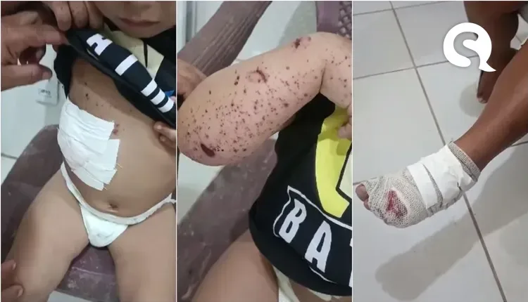 Raio atinge casa e deixa três feridos em Jijoca de Jericoacoara