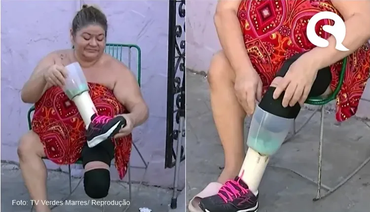 À espera de prótese, mulher com perna amputada improvisa com liquidificador em Sobral