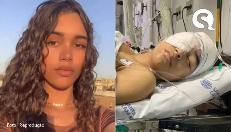 Jovem de 16 anos quase fica cega por conta de sinusite bacteriana; entenda doença e sintomas