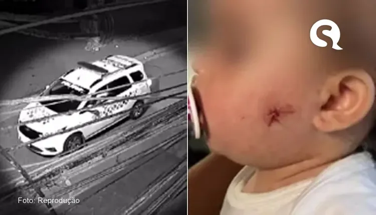 PM atira no rosto de bebê de um ano com arma de airsoft em São Paulo
