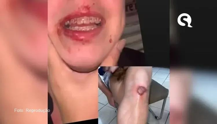 Policial preso por agredir DJ durante festa de carnaval em São Benedito é afastado