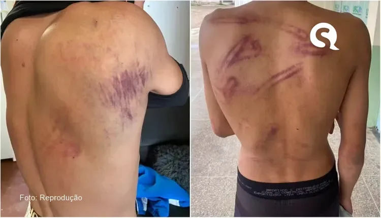 Jovens são levados a rua deserta e espancados por seguranças durante festa de carnaval em Tianguá
