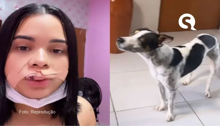 Mulher tenta beijar cachorro e tem parte do lábio arrancado após mordida