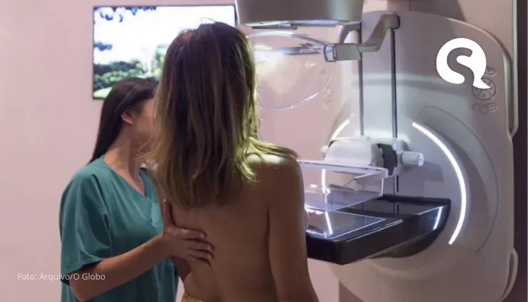 Secretaria da Saúde de Sobral realizará exames de mamografia para mulheres de 50 a 69 anos