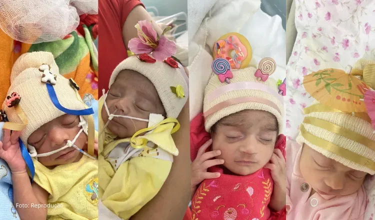 Santa Casa de Sobral entra na trend e promove ação “touca maluca” com bebês internados
