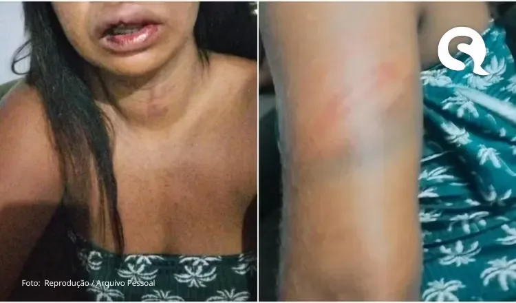 Mulher é agredida por atrasar 12 minutos para pegar companheiro no local de trabalho