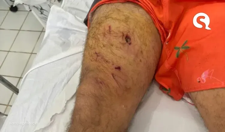 Idoso de 67 anos é mordido por jacaré em lagoa na Grande Fortaleza