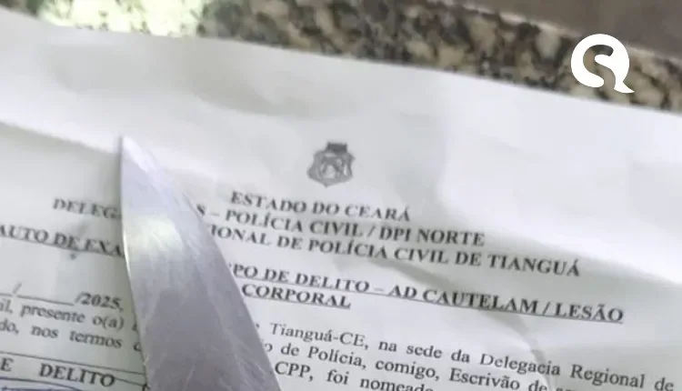 Três PMs são esfaqueados enquanto trabalhavam no Réveillon de Tianguá