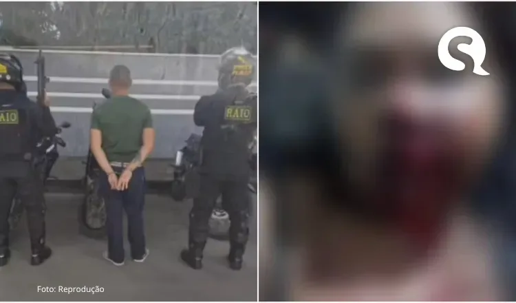 Homem é preso por desfigurar rosto de companheira com socos enquanto ela dormia
